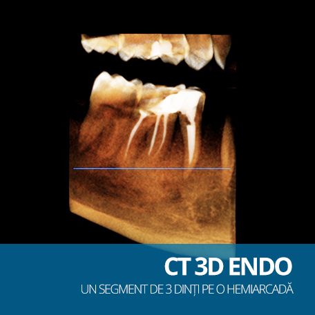 CT ENDO