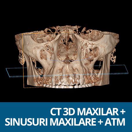 CT MAXILAR+SINUSURI+ATM