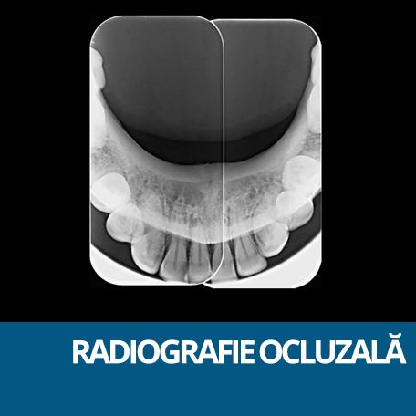 RX OCLUZAL