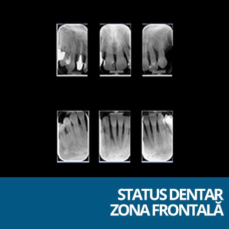 STATUS DENTAR FRONT